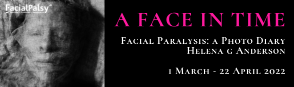 A Face in Time: Facial Paralysis - A photo diary, Helena G Anderson, 1 March-22 April 2022