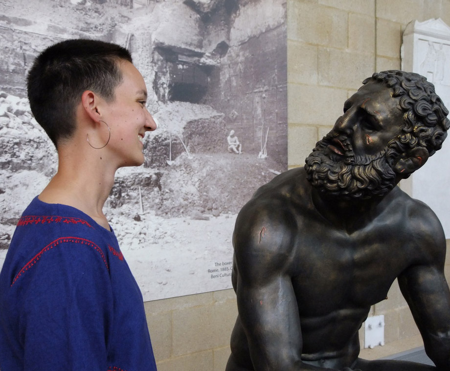 a young woman with a shaved head smiles at a bronze boxer with facial wounds