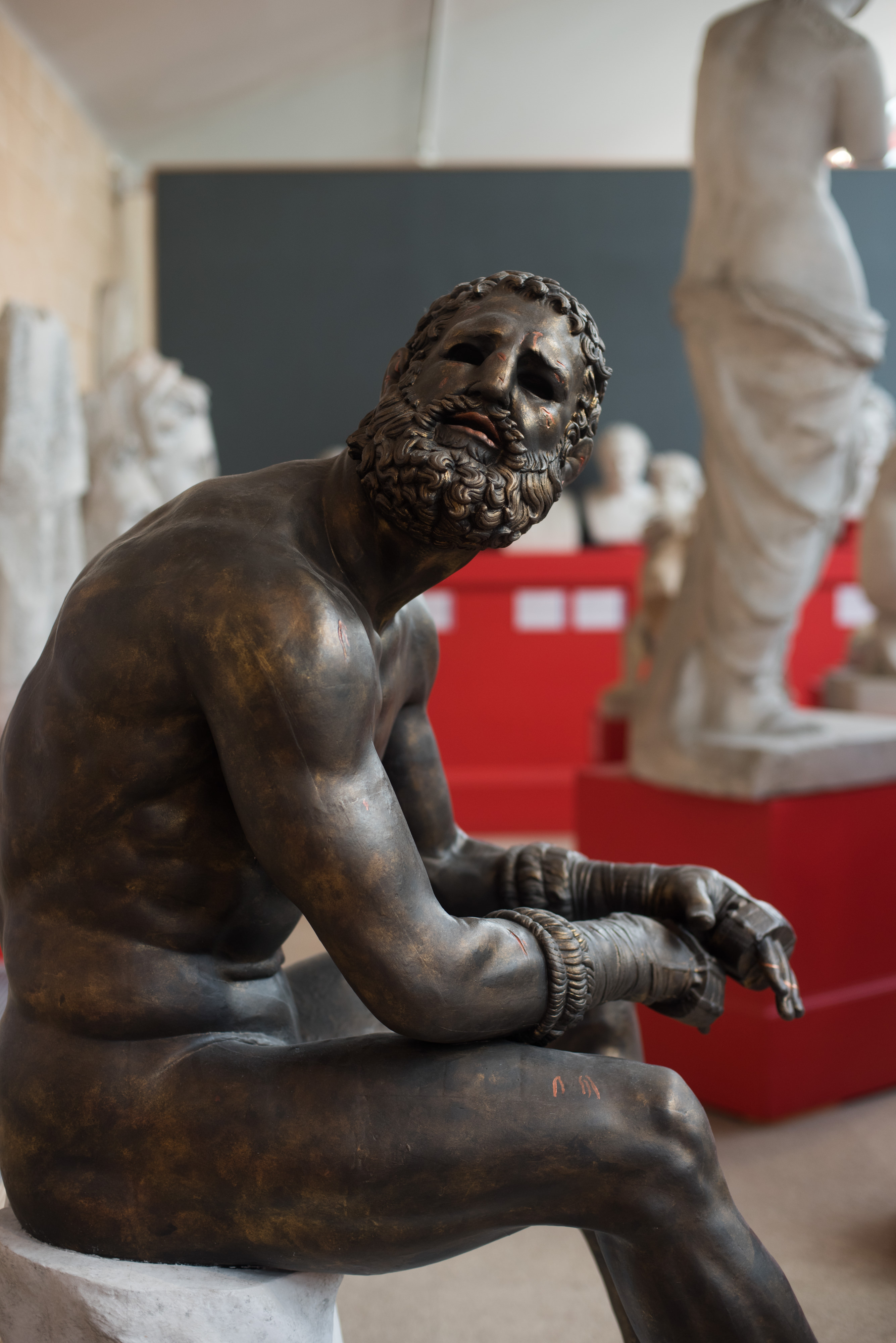 bronze boxer sitting, with arms resting on knees, looking up with a bloody face