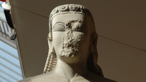 head of sounion kouros with damage to face, large almond-shaped eyes, and braided hairstyle