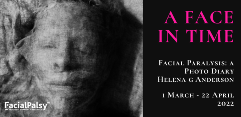 A Face in Time: Facial Paralysis - A photo diary, Helena G Anderson